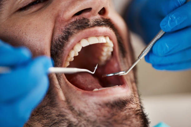 Best Urgent Care for Lost Fillings or Crowns in Cornish, ME