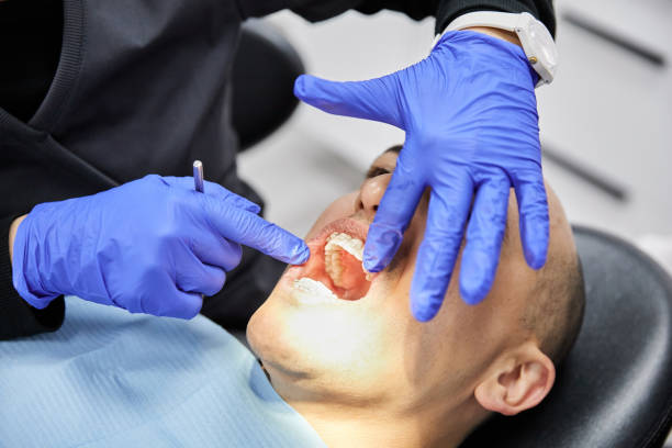 Best Emergency Root Canal Treatment in Cornish, ME